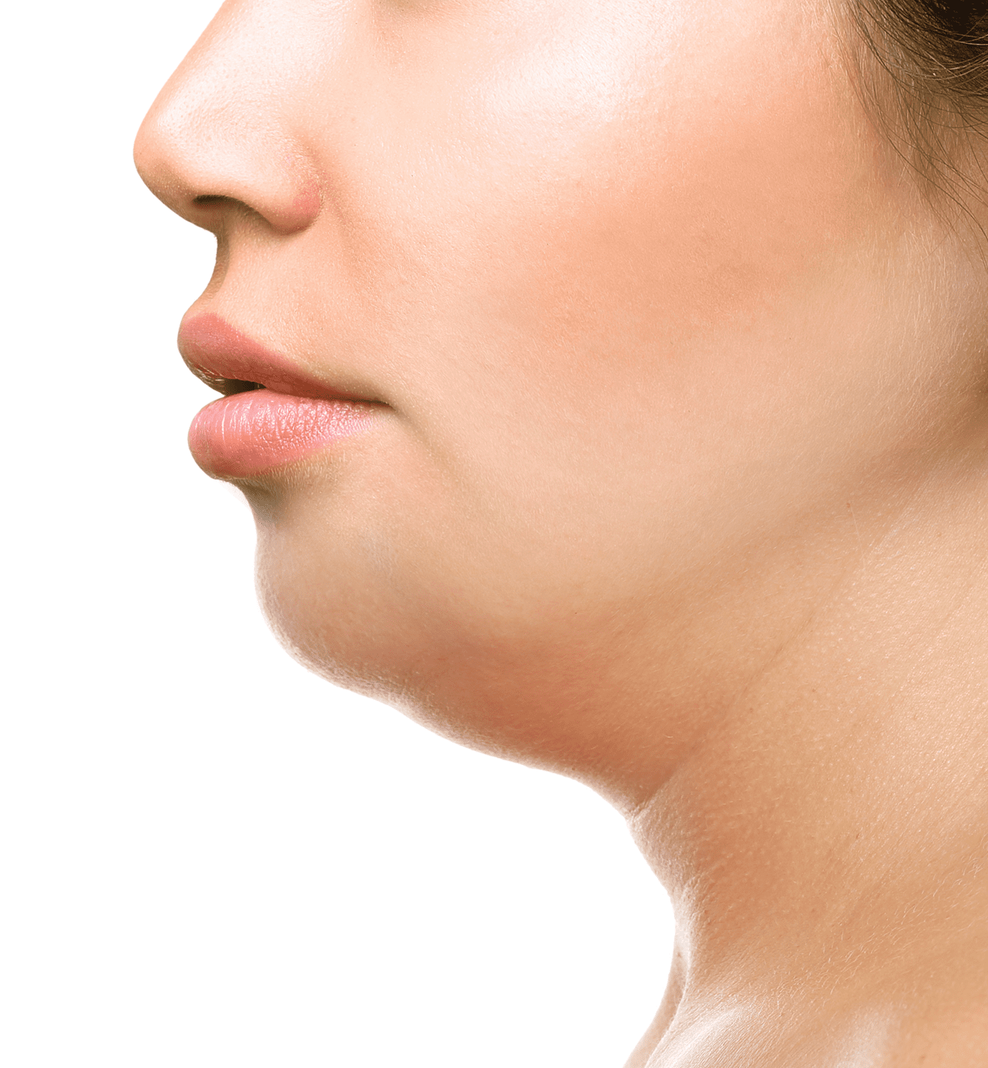 double chin fat dissolving