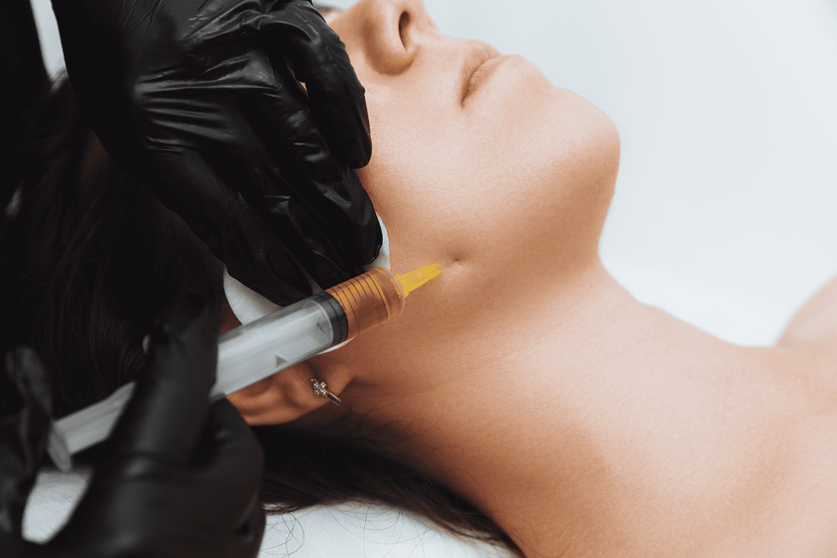 woman receiving prp on her face