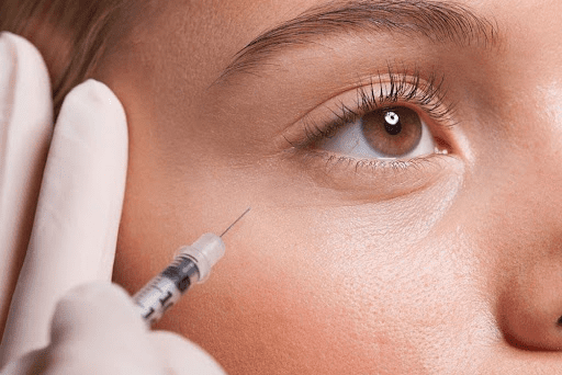 woman receiving dermal filler in London Ontario