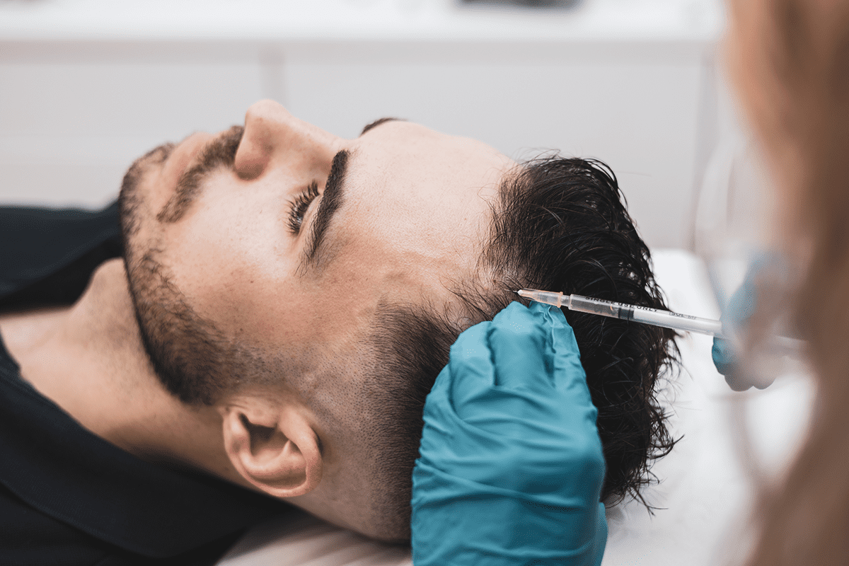 closeup of man receiving PRP treatment in his hair to maintain and grow healthy hair