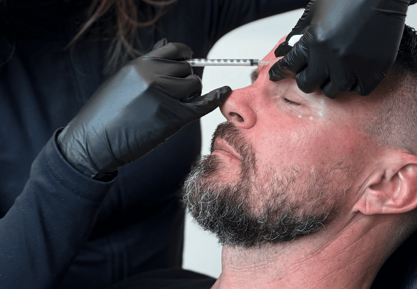 man receiving botox in his forehead