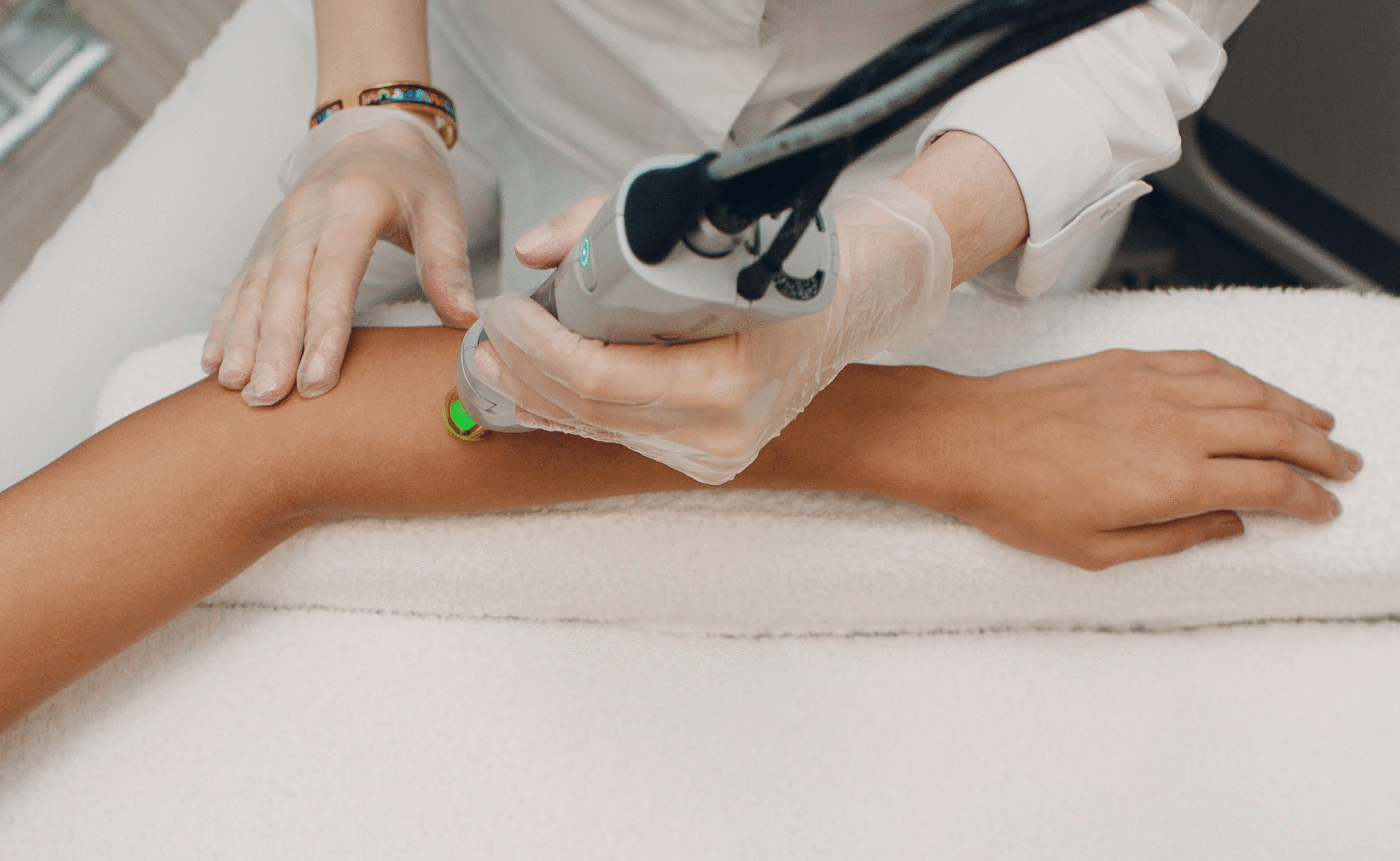 moxi laser being user on a womans arm with skin pigmentation